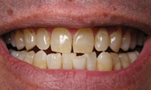 iO Dentistry